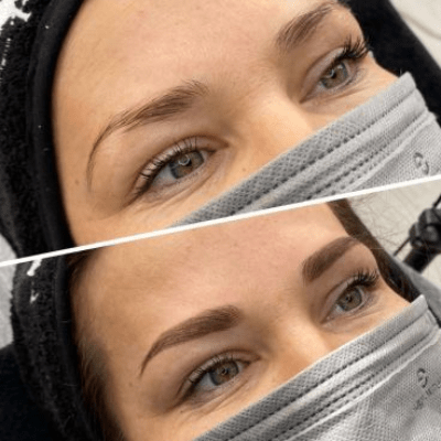 MICROSHADING